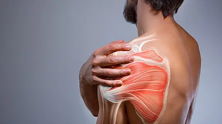 Shoulder Pain