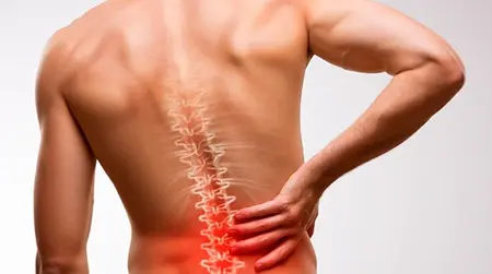 Chronic Back Pain