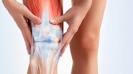 Osteoarthritis Knee