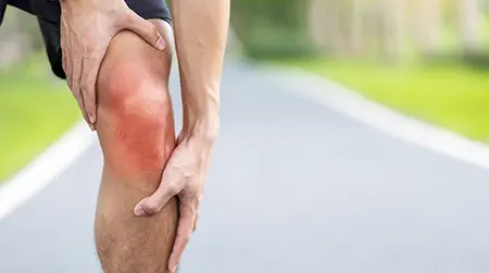 Patellofemoral Pain