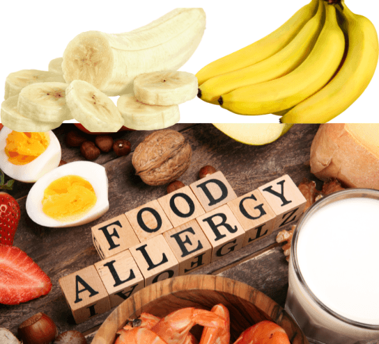 Banana Allergy Rhinitis - Effective Solutions & Treatments | PDM Hospital