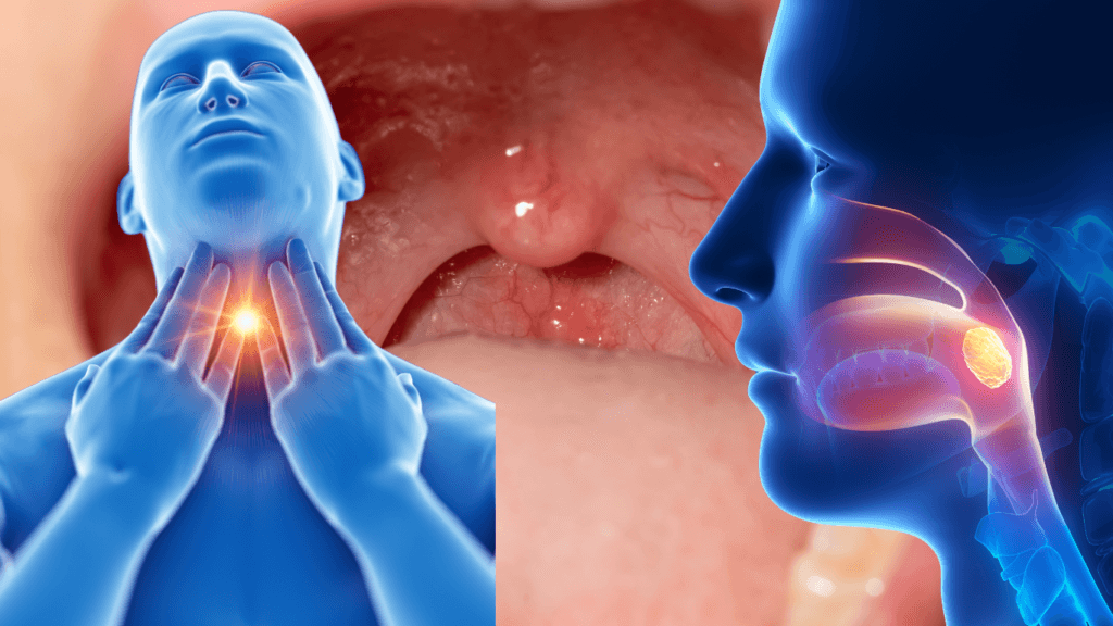 Tonsils: Causes, Symptoms, Treatment & Prevention Guide