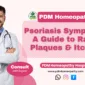 Psoriasis Symptoms: A Guide to Rash, Plaques & Itching