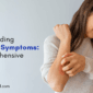 Understanding Psoriasis Symptoms