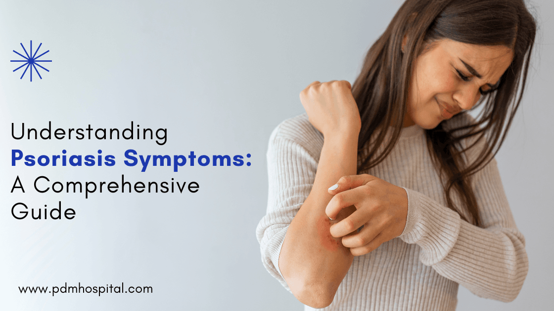 Understanding Psoriasis Symptoms