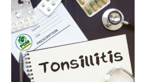 Tonsillitis: Causes, Symptoms and Treatment