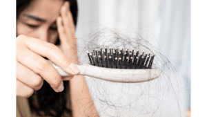 Hairfall: Causes, Symptoms and Treatments