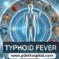 Typhoid Fever: Causes, Symptoms, Treatment and Prevention