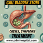 Gallbladder Stone: Symptoms, Causes and Treatment