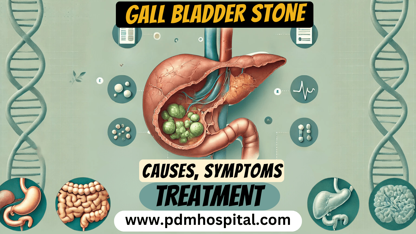 Gallbladder Stone: Symptoms, Causes and Treatment