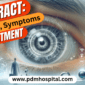 Cataracts: Symptoms, Causes and Treatment