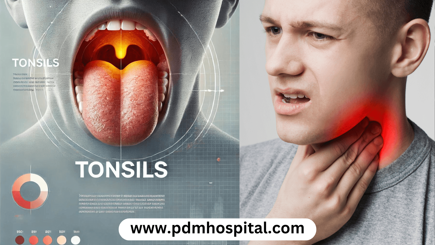 Tonsillitis: Causes, Symptoms and Treatment