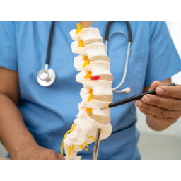 Homeopathy treatment for slip disc patient