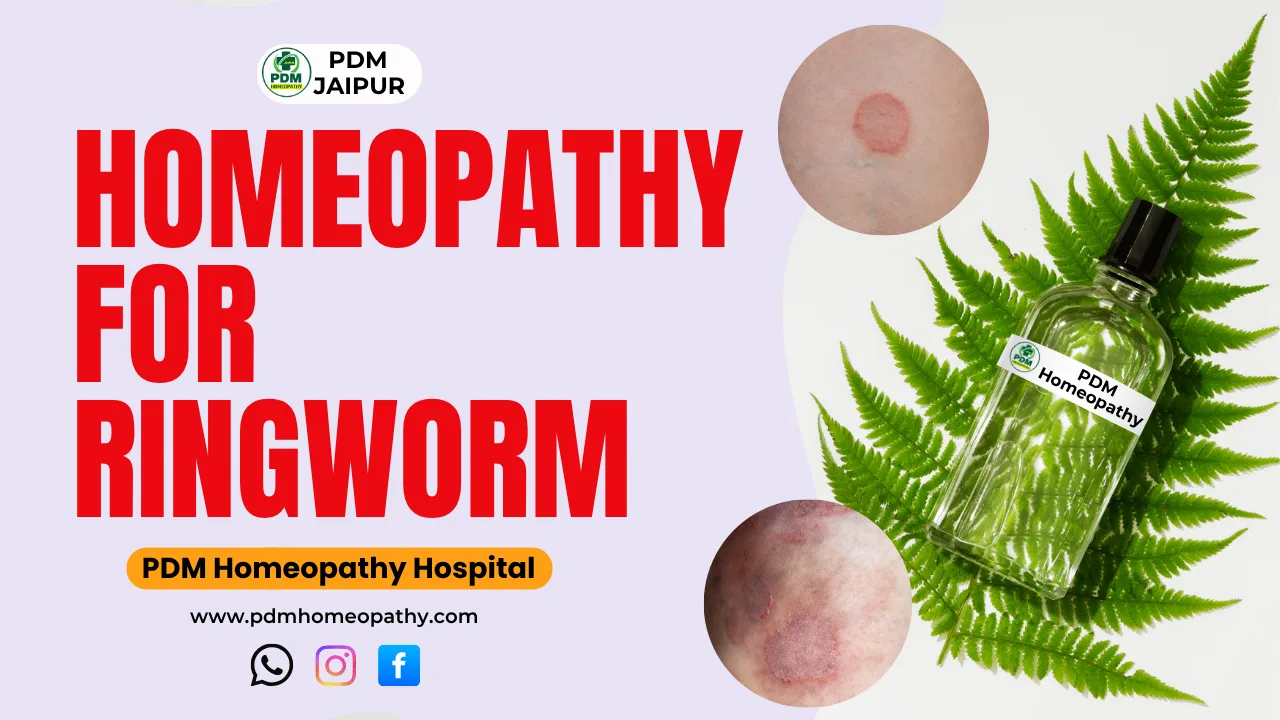 Homeopathy for Ringworm: An Effective, Lasting Solution - PDM Homeopathy